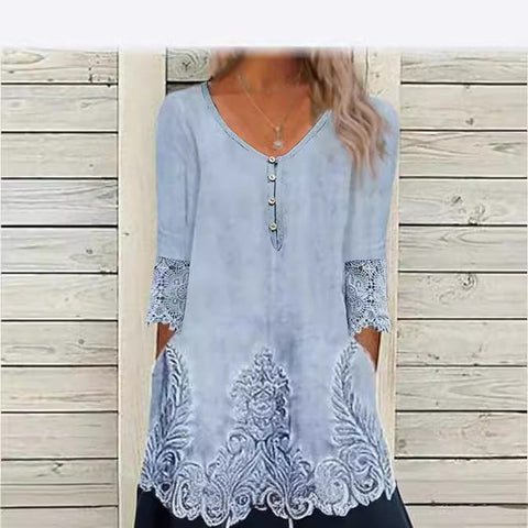 Lace splicing dress, women's print short-sleeved skirt m300386